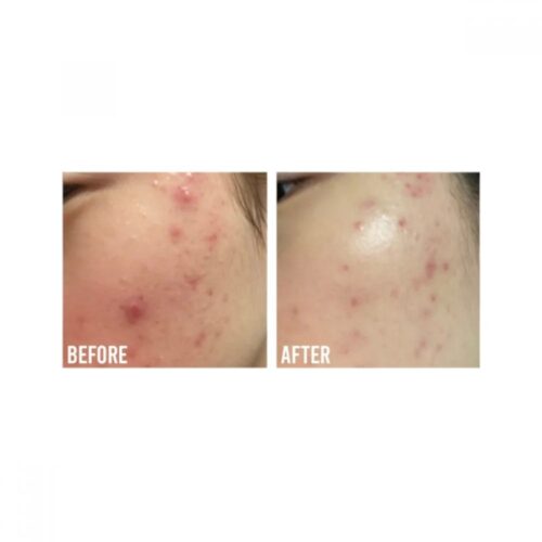 Beauty Of Joseon Calming Serum Green Tea+ Panthenol