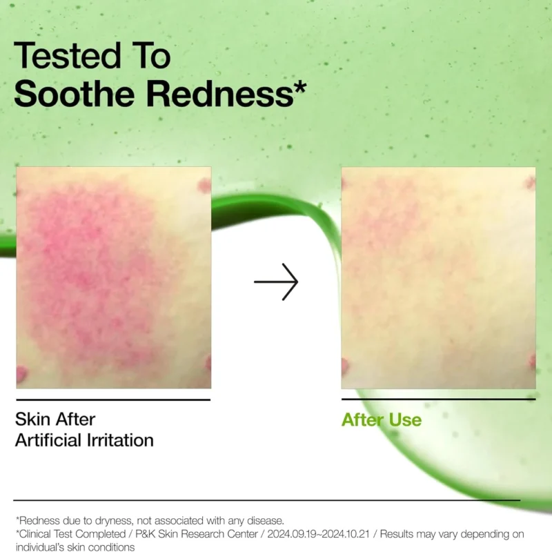 ANUA Azelaic Acid 10 Hyaluron Redness Soothing Serum