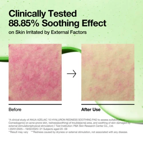 ANUA Soothing Pad Azelaic 10+ Hyaluron
